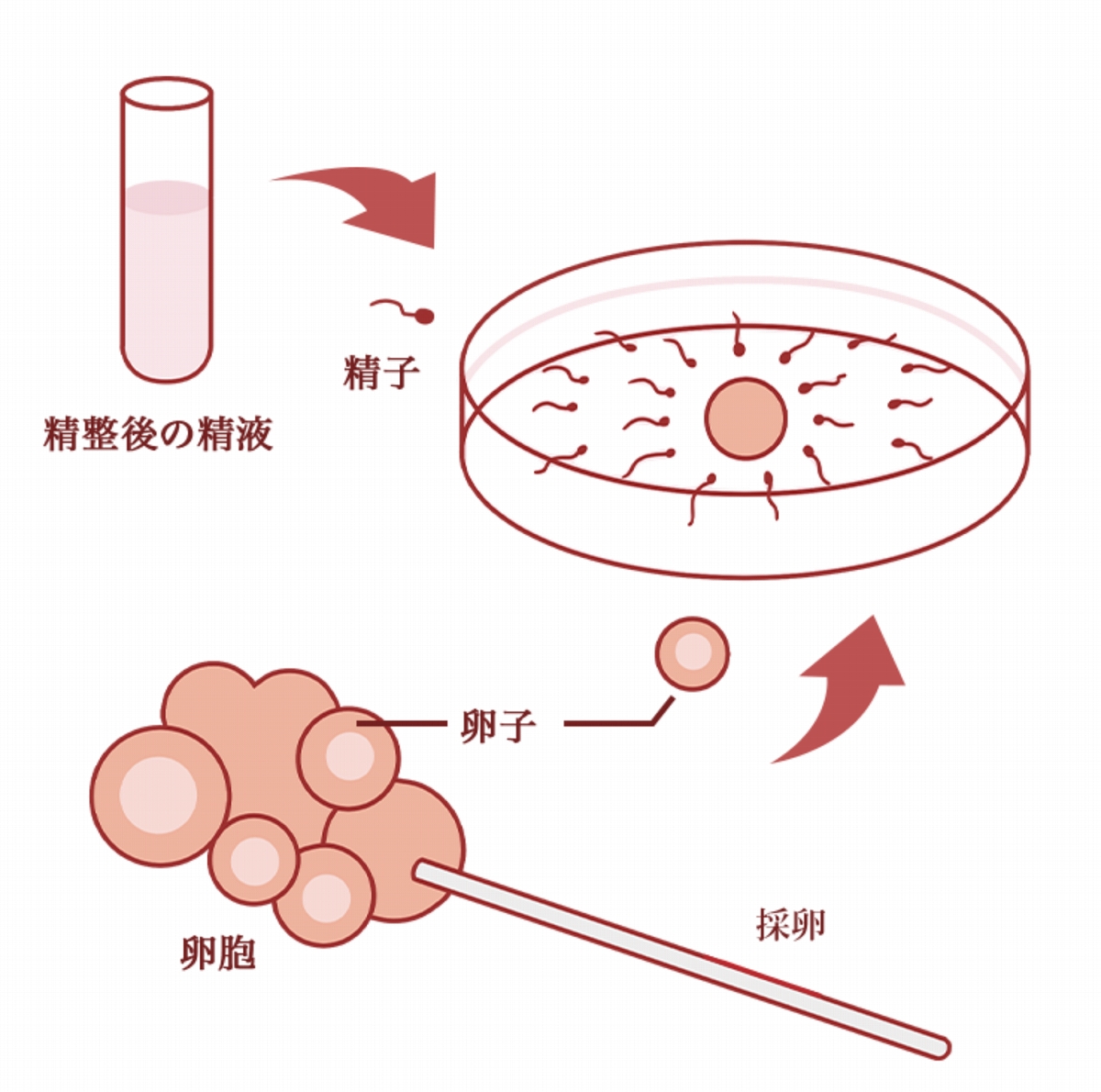 体外受精・胚移植について