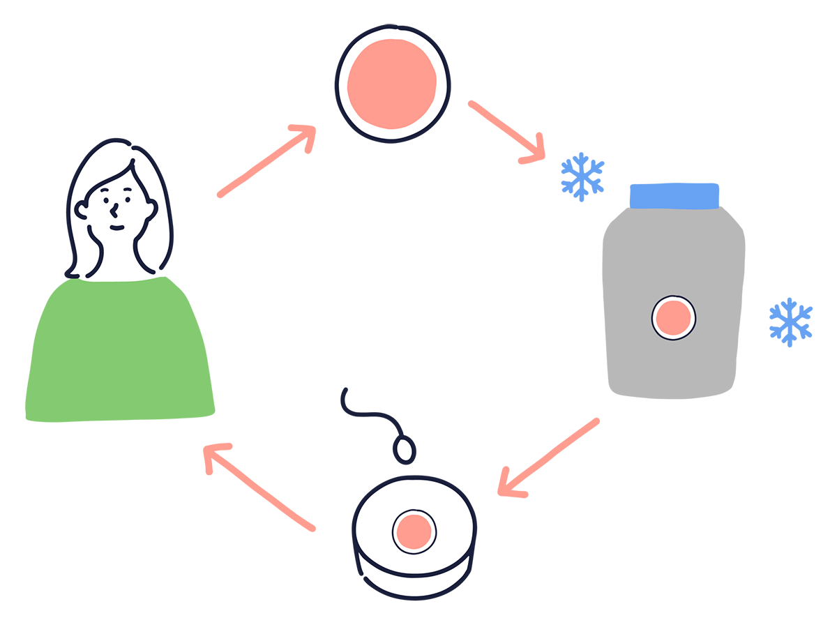 卵子凍結とは