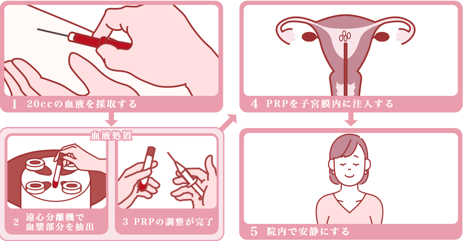 基本的には月経から10日目頃と12日目頃に2回セットで行います。